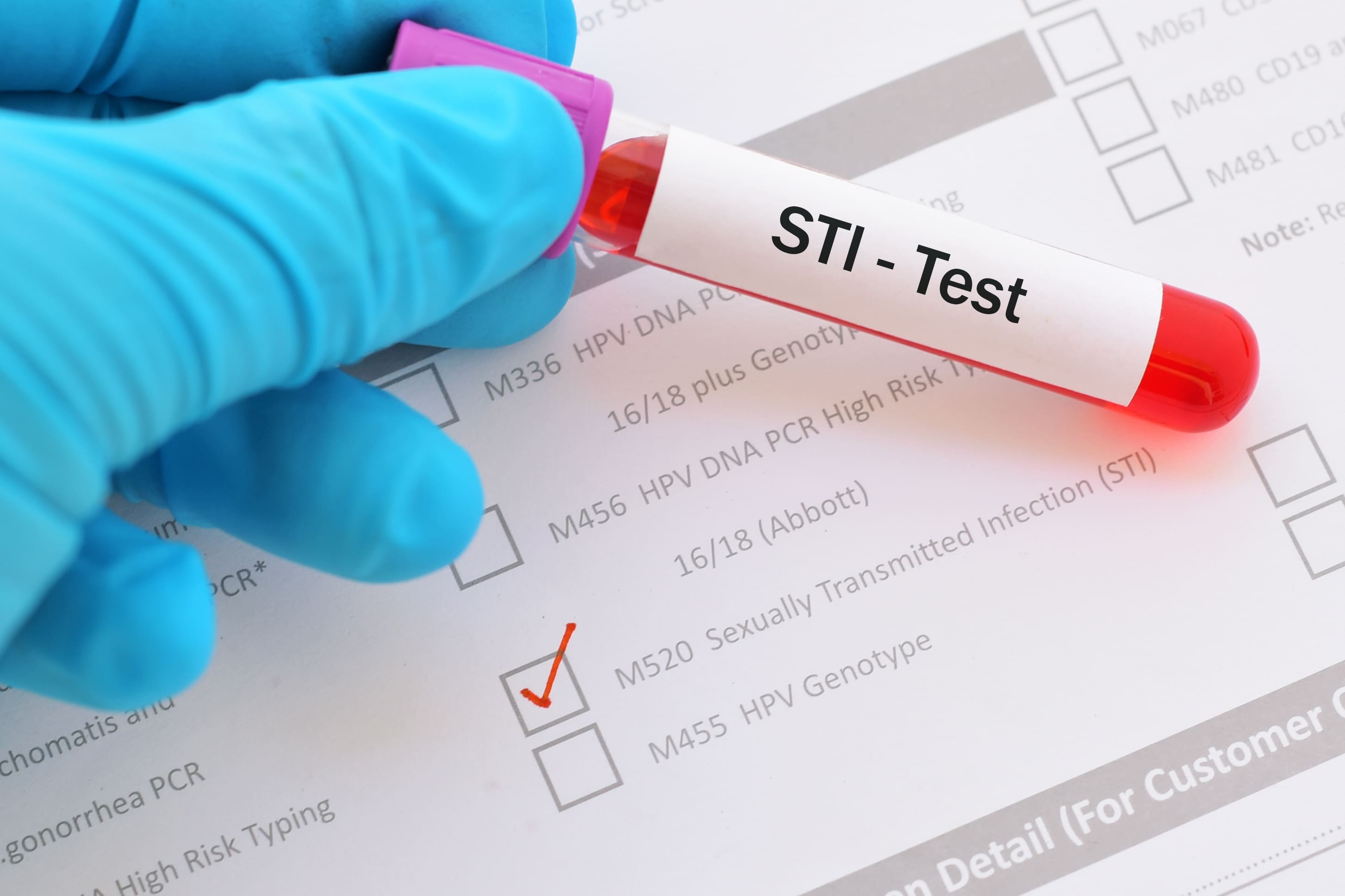 STI test tube